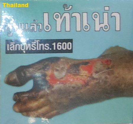 Cigarette Warning (Thailand): foot gangrene