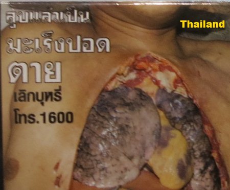Cigarette Warning (Thailand): lung cancer