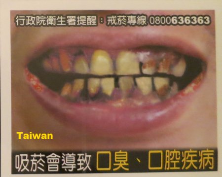 Cigarette Warning (Taiwan): bad teeth and breath