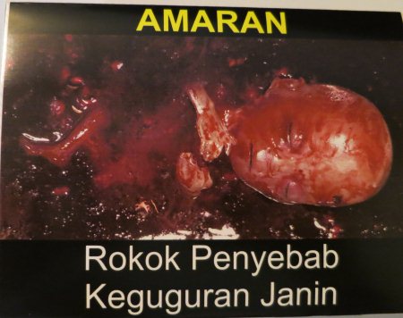 Cigarette Warning (Malaysia): miscarriage