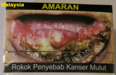 Cigarette Warning (Malaysia): mouth cancer