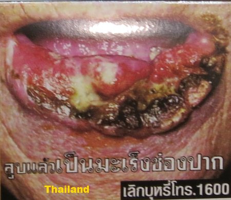 Cigarette Warning (Thailand): mouth cancer